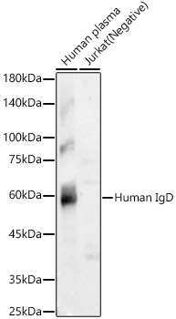 Western blot analysis of various lysates using Human IgD Rabbit mAb at 1:3000 dilution.|Secondary antibody: HRP-conjugated Goat anti-Rabbit IgG (H+L) at 1:10000 dilution.|Lysates/proteins: 25μg per lane.|Blocking buffer: 3% nonfat dry milk in TBST.|Detection: ECL Basic Kit.|Exposure time: 180s.