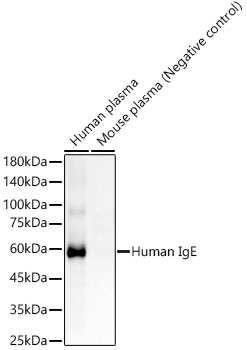 Western blot analysis of various lysates, using Human IgE Rabbit mAb at 1:1000 dilution.|Secondary antibody: HRP-conjugated Goat anti-Rabbit IgG (H+L) at 1:10000 dilution.|Lysates/proteins: 25μg per lane.|Blocking buffer: 3% nonfat dry milk in TBST.|Detection: ECL Enhanced Kit.|Exposure time: 60s.
