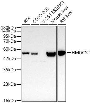 Western blot analysis of various lysates using HMGCS2 Rabbit mAb at 1:2000 dilution incubated overnight at 4℃.|Secondary antibody: HRP-conjugated Goat anti-Rabbit IgG (H+L) at 1:10000 dilution.|Lysates/proteins: 25 μg per lane.|Blocking buffer: 3% nonfat dry milk in TBST.|Detection: ECL Basic Kit.|Negative control (NC): U-251 MG|Exposure time: 10s.