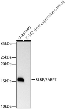 Western blot analysis of various lysates, using BLBP/FABP7 Rabbit mAb at 1:5000 dilution.|Secondary antibody: HRP-conjugated Goat anti-Rabbit IgG (H+L) at 1:10000 dilution.|Lysates/proteins: 25μg per lane.|Blocking buffer: 3% nonfat dry milk in TBST.|Detection: ECL Basic Kit.|Exposure time: 10s.