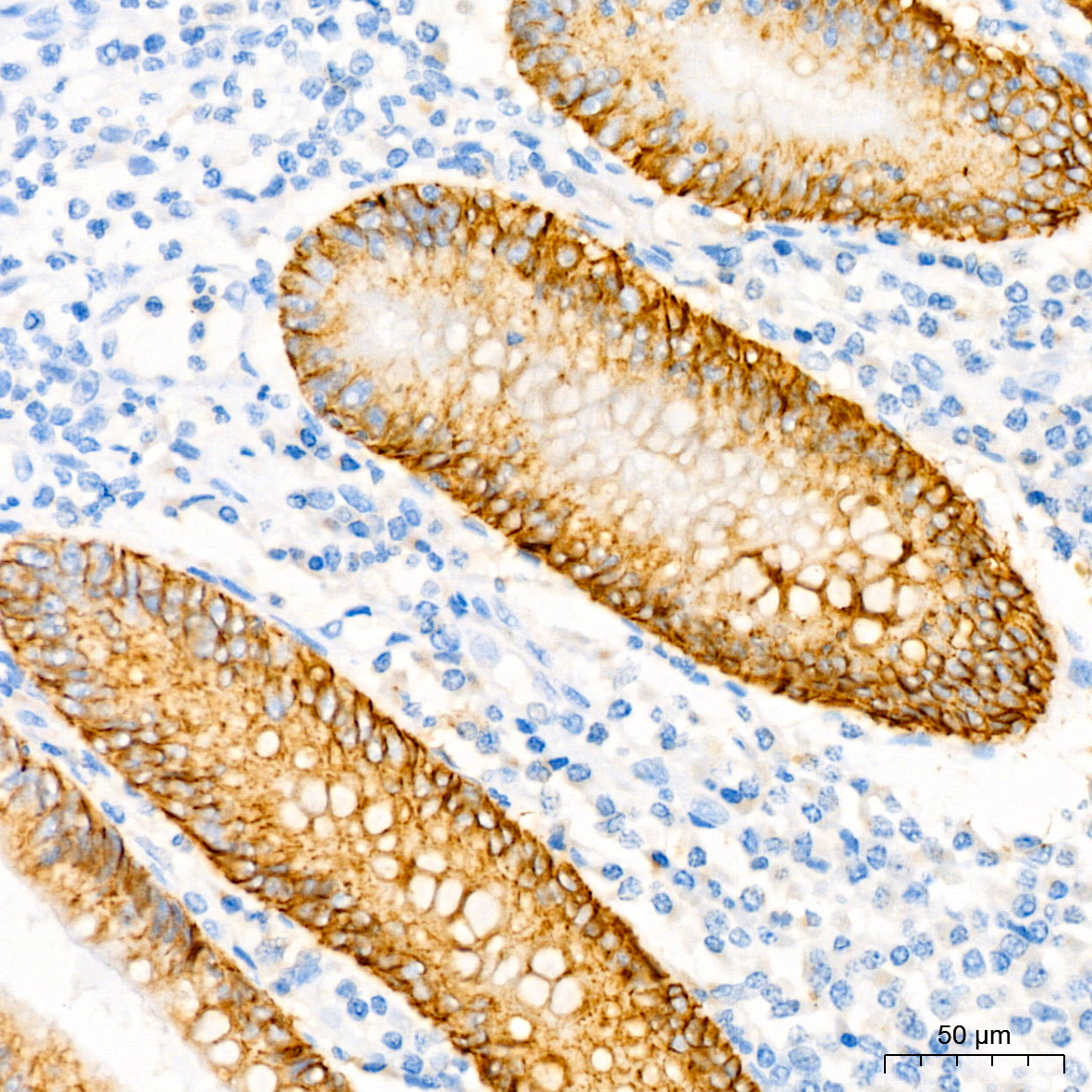 Immunohistochemistry analysis of paraffin-embedded Human appendix using CD138/Syndecan-1 Rabbit mAb at dilution of 1:100 (40x lens). High pressure antigen retrieval performed with 0.01M Tris/EDTA Buffer (pH 9.0) prior to IHC staining.
