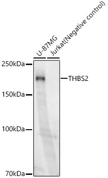 Western blot analysis of various lysates, using THBS2 Rabbit mAb at 1:1000 dilution.|Secondary antibody: HRP-conjugated Goat anti-Rabbit IgG (H+L) at 1:10000 dilution.|Lysates/proteins: 25μg per lane.|Blocking buffer: 3% nonfat dry milk in TBST.|Detection: ECL Enhanced Kit.|Exposure time: 180s.