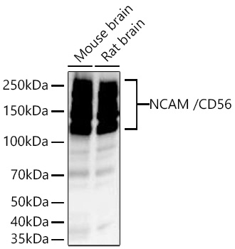 Western blot analysis of various lysates using NCAM /CD56 Rabbit mAb at 1:2000 dilution incubated overnight at 4℃.|Secondary antibody: HRP-conjugated Goat anti-Rabbit IgG (H+L) at 1:10000 dilution.|Lysates/proteins: 25 μg per lane.|Blocking buffer: 3% nonfat dry milk in TBST.|Detection: ECL Basic Kit.|Exposure time: 20s.