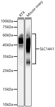 Western blot analysis of various lysates, using SLC14A1 Rabbit mAb at 1:1000 dilution.|Secondary antibody: HRP-conjugated Goat anti-Rabbit IgG (H+L) at 1:10000 dilution.|Lysates/proteins: 25μg per lane.|Blocking buffer: 3% nonfat dry milk in TBST.|Detection: ECL Basic Kit.|Exposure time: 180s.