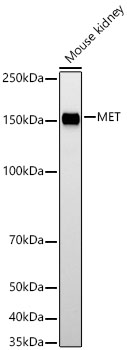 Western blot analysis of lysates from Mouse kidney using MET Rabbit mAb at 1:1000 dilution.|Secondary antibody: HRP-conjugated Goat anti-Rabbit IgG (H+L) at 1:10000 dilution.|Lysates/proteins: 25 μg per lane.|Blocking buffer: 3% nonfat dry milk in TBST.|Detection: ECL Basic Kit.|Exposure time: 30s.