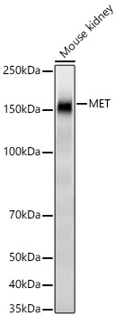 Western blot analysis of lysates from Mouse kidney using MET Rabbit mAb at 1:1000 dilution.|Secondary antibody: HRP-conjugated Goat anti-Rabbit IgG (H+L) at 1:10000 dilution.|Lysates/proteins: 25 μg per lane.|Blocking buffer: 3% nonfat dry milk in TBST.|Detection: ECL Basic Kit.|Exposure time: 10s.