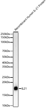 Western blot analysis of various lysates, using IL21 Rabbit mAb at 1:1000 dilution.|Secondary antibody: HRP-conjugated Goat anti-Rabbit IgG (H+L) at 1:10000 dilution.|Lysates/proteins: 25μg per lane.|Blocking buffer: 3% nonfat dry milk in TBST.|Detection: ECL Basic Kit.|Exposure time: 10s.