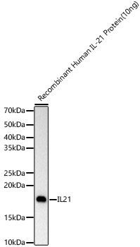 Western blot analysis of Recombinant Human IL-21 Protein  using IL21 Rabbit mAb at 1:2000 dilution.|Secondary antibody: HRP-conjugated Goat anti-Rabbit IgG (H+L) at 1:10000 dilution.|Lysates/proteins: 10ng per lane.|Blocking buffer: 3% nonfat dry milk in TBST.|Detection: ECL Basic Kit.|Exposure time: 1s.