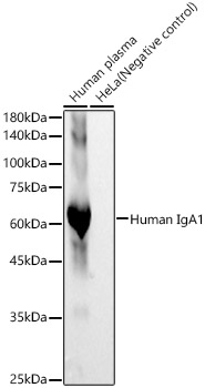 Western blot analysis of various lysates, using Human IgA1 Rabbit mAb at 1:1000 dilution.|Secondary antibody: HRP-conjugated Goat anti-Rabbit IgG (H+L) at 1:10000 dilution.|Lysates/proteins: 25μg per lane.|Blocking buffer: 3% nonfat dry milk in TBST.|Detection: ECL Basic Kit.|Exposure time: 30s.