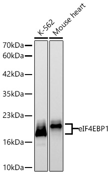 Western blot analysis of various lysates using [KD Validated] eIF4EBP1 Rabbit mAb at 1:1000 dilution incubated overnight at 4℃.|Secondary antibody: HRP-conjugated Goat anti-Rabbit IgG (H+L) at 1:10000 dilution.|Lysates/proteins: 25 μg per lane.|Blocking buffer: 3% nonfat dry milk in TBST.|Detection: ECL Basic Kit.|Exposure time: 20s.