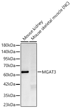 Western blot analysis of various lysates using MGAT3 Rabbit mAb at 1:1000 dilution.|Secondary antibody: HRP-conjugated Goat anti-Rabbit IgG (H+L) at 1:10000 dilution.|Lysates/proteins: 25μg per lane.|Blocking buffer: 3% nonfat dry milk in TBST.|Detection: ECL Basic Kit.|Negative control (NC): mouse skeletal muscle.|Exposure time: 45s.