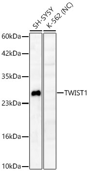Western blot analysis of various lysates using TWIST1 Rabbit mAb at 1:1000 dilution.|Secondary antibody: HRP-conjugated Goat anti-Rabbit IgG (H+L) at 1:10000 dilution.|Lysates/proteins: 25 μg per lane.|Blocking buffer: 3% nonfat dry milk in TBST.|Detection: ECL Basic Kit.|Negative control (NC): K-562.|Exposure time: 90s.