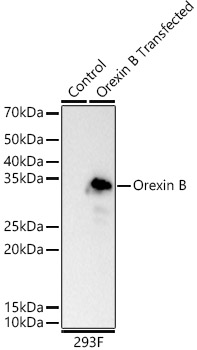 Western blot analysis of wild type (WT) and 293F cells transfected with Orexin B, using Orexin B Rabbit mAb at 1:1000 dilution.|Secondary antibody: HRP-conjugated Goat anti-Rabbit IgG (H+L) at 1:10000 dilution.|Lysates/proteins: 25μg  per lane.|Blocking buffer: 3% nonfat dry milk in TBST.|Detection: ECL Basic Kit.|Exposure time: 30s.