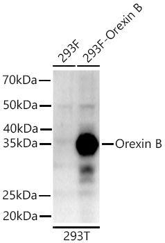Western blot analysis of lysates from wild type (WT) and 293F cells transfected with Orexin B  using Orexin B Rabbit mAb at 1:1000 dilution incubated overnight at 4℃.|Secondary antibody:  () at 1:10000 dilution.|Lysates/proteins: 20 μg per lane.|Blocking buffer: 3% nonfat dry milk in TBST.|Detection: ECL Enhanced Kit|.Exposure time: 90s.