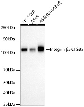 Western blot analysis of various lysates using Integrin β5/ITGB5 Rabbit mAb at 1:1000 dilution incubated at room temperature for 1.5 hours.|Secondary antibody: HRP-conjugated Goat anti-Rabbit IgG (H+L) at 1:10000 dilution.|Lysates/proteins: 25 μg per lane.|Blocking buffer: 3% nonfat dry milk in TBST.|Detection: ECL Basic Kit.|Exposure time: 45 s.