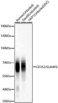 Western blot analysis of various lysates using CD352/SLAMF6 Rabbit mAb at 1:3000 dilution incubated at room temperature for 1.5 hours.|Secondary antibody: HRP-conjugated Goat anti-Rabbit IgG (H+L) at 1:10000 dilution.|Lysates/proteins: 25 μg per lane.|Blocking buffer: 3% nonfat dry milk in TBST.|Detection: ECL Basic Kit.|Negative control (NC): HAP1.|Exposure time: 45 s.