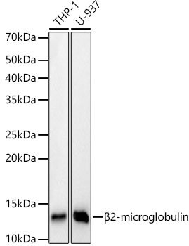 Western blot analysis of various lysates, using [KD Validated] beta 2 Microglobulin Rabbit mAb at 1:1000 dilution.|Secondary antibody: HRP-conjugated Goat anti-Rabbit IgG (H+L) at 1:10000 dilution.|Lysates/proteins: 25μg per lane.|Blocking buffer: 3% nonfat dry milk in TBST.|Detection: ECL Basic Kit.|Exposure time: 30s.