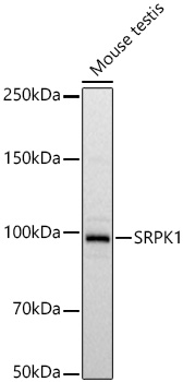 Western blot analysis of lysates from Mouse testis using SRPK1 Rabbit mAb at 1:2000 dilution incubated overnight at 4℃.|Secondary antibody: HRP-conjugated Goat anti-Rabbit IgG (H+L) at 1:10000 dilution.|Lysates/proteins: 25 μg per lane.|Blocking buffer: 3% nonfat dry milk in TBST.|Detection: ECL Basic Kit.|Exposure time: 1s.