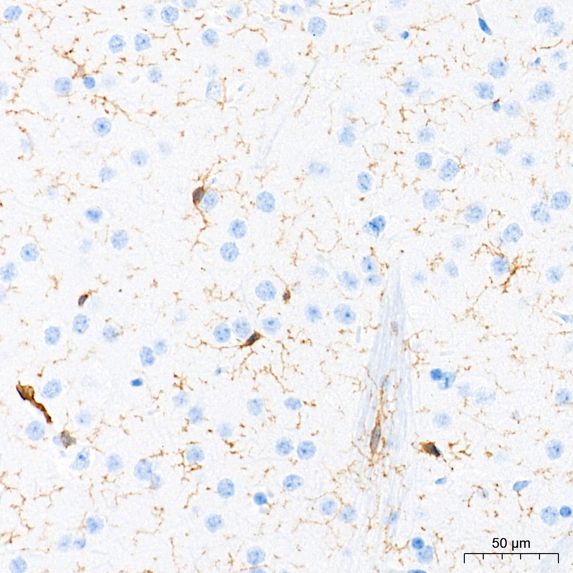 Immunohistochemistry analysis of paraffin-embedded Mouse brain tissue using F4/80 Rabbit mAb at a dilution of 1:500 (40x lens). High pressure antigen retrieval performed with 0.01M Tris-EDTA Buffer (pH 9.0) prior to IHC staining.