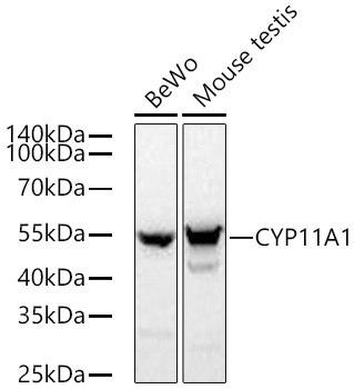 Western blot analysis of various lysates using CYP11A1 Rabbit mAb at 1:1000 dilution incubated overnight at 4℃.|Secondary antibody: HRP-conjugated Goat anti-Rabbit IgG (H+L) at 1:10000 dilution.|Lysates/proteins: 25 μg per lane.|Blocking buffer: 3% nonfat dry milk in TBST.|Detection: ECL Basic Kit.|Exposure time: 90 s.