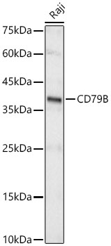 Western blot analysis of lysates from Raji cells, using CD79B Rabbit mAb at 1:1000 dilution.|Secondary antibody: HRP-conjugated Goat anti-Rabbit IgG (H+L) at 1:10000 dilution.|Lysates/proteins: 25μg per lane.|Blocking buffer: 3% nonfat dry milk in TBST.|Detection: ECL Basic Kit.|Exposure time: 10s.
