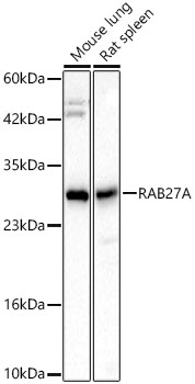 Western blot analysis of various lysates, using [KD Validated] RAB27A Rabbit mAb at 1:3000 dilution.|Secondary antibody: HRP-conjugated Goat anti-Rabbit IgG (H+L) at 1:10000 dilution.|Lysates/proteins: 25μg per lane.|Blocking buffer: 3% nonfat dry milk in TBST.|Detection: ECL Basic Kit.|Exposure time: 45s.