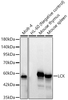Western blot analysis of various lysates, using LCK at 1:1000 dilution.|Secondary antibody: HRP-conjugated Goat anti-Rabbit IgG (H+L) at 1:10000 dilution.|Lysates/proteins: 25μg per lane.|Blocking buffer: 3% nonfat dry milk in TBST.|Detection: ECL Basic Kit.|Exposure time: 20s.