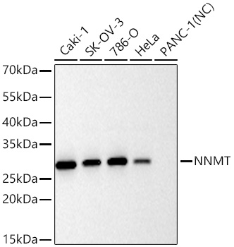 Western blot analysis of various lysates using NNMT Rabbit mAb at 1:5000 dilution incubated overnight at 4℃.|Secondary antibody: HRP-conjugated Goat anti-Rabbit IgG (H+L) at 1:10000 dilution.|Lysates/proteins: 25 μg per lane.|Blocking buffer: 3% nonfat dry milk in TBST.|Detection: ECL Basic Kit.|Negative control (NC): PANC-1.|Exposure time: 20 s.