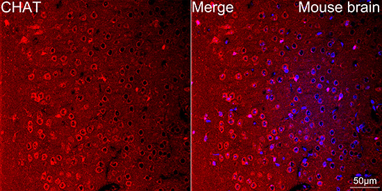 Confocal imaging of paraffin-embedded Mouse brain tissue using CHAT Rabbit mAb followed by a further incubation with Cy3 Goat Anti-Rabbit IgG (H+L) (Red). DAPI was used for nuclear staining (Blue). High pressure antigen retrieval performed with 0.01M Citrate Buffer (pH 6.0) prior to IF staining. Objective: 40x.