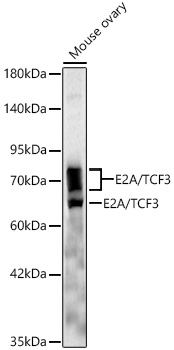 Western blot analysis of lysates from Mouse ovary, using E2A/TCF3 Rabbit mAb at 1:1000 dilution.|Secondary antibody: HRP-conjugated Goat anti-Rabbit IgG (H+L) at 1:10000 dilution.|Lysates/proteins: 25μg per lane.|Blocking buffer: 3% nonfat dry milk in TBST.|Detection: ECL Basic Kit.|Exposure time: 180s.