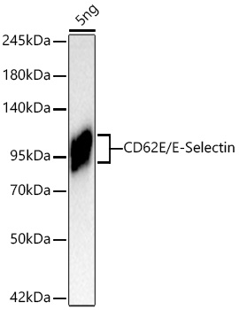 Western blot analysis of lysates from Recombinant Human E-Selectin/CD62E Protein  cells using CD62E/E-Selectin Rabbit mAb at 1:1000 dilution incubated overnight at 4℃.|Secondary antibody: HRP-conjugated Goat anti-Rabbit IgG (H+L) at 1:10000 dilution.|Lysates/proteins: 5ng μg per lane.|Blocking buffer: 3% nonfat dry milk in TBST.|Detection: ECL Basic Kit.|Exposure time: 1s.
