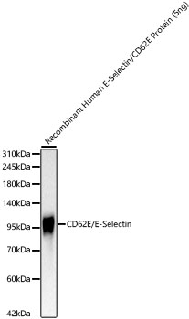 Western blot analysis of Recombinant Human SELE/E-selectin/CD62E Protein , using CD62E/E-Selectin Rabbit mAb at 1:1000 dilution.|Secondary antibody: HRP-conjugated Goat anti-Rabbit IgG (H+L) at 1:10000 dilution.|Lysates/proteins: 5ng per lane.|Blocking buffer: 3% nonfat dry milk in TBST.|Detection: ECL Basic Kit.|Exposure time: 30s.