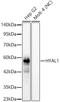 Western blot analysis of various lysates, using HYAL1 Rabbit mAb at 1:1500 dilution.|Secondary antibody: HRP-conjugated Goat anti-Rabbit IgG (H+L) at 1:10000 dilution.|Lysates/proteins: 25μg per lane.|Blocking buffer: 3% nonfat dry milk in TBST.|Detection: ECL Basic Kit.|Negative control (NC): MOLT-4|Exposure time: 60s.