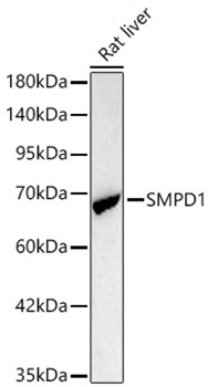 Western blot analysis of lysates from Rat liver using SMPD1 Rabbit mAb at 1:1000 dilution incubated overnight at 4℃.|Secondary antibody: HRP-conjugated Goat anti-Rabbit IgG (H+L) at 1:10000 dilution.|Lysates/proteins: 25μg per lane.|Blocking buffer: 3% nonfat dry milk in TBST.|Detection: ECL Basic Kit.|Exposure time: 90s.