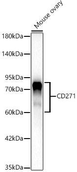 Western blot analysis of lysates from Mouse ovary using CD271 Rabbit mAb at 1:1000 dilution.|Secondary antibody: HRP-conjugated Goat anti-Rabbit IgG (H+L) at 1:10000 dilution.|Lysates/proteins: 25 μg per lane.|Blocking buffer: 3% nonfat dry milk in TBST.|Detection: ECL Basic Kit.|Exposure time: 30 s.
