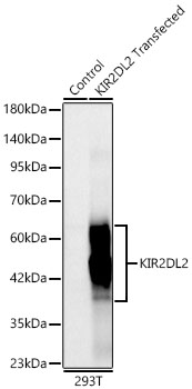 Western blot analysis of lysates from wild type (WT) and 293T cells transfected with KIR2DL2, using KIR2DL2/KIR2DL3 Rabbit mAb at 1:2000 dilution.|Secondary antibody: HRP-conjugated Goat anti-Rabbit IgG (H+L) at 1:10000 dilution.|Lysates/proteins: 25 μg per lane.|Blocking buffer: 3% nonfat dry milk in TBST.|Detection: ECL Basic Kit.|Exposure time: 10s.