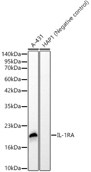 Western blot analysis of various lysates, using IL-1RA Rabbit mAb at 1:2000 dilution.|Secondary antibody: HRP-conjugated Goat anti-Rabbit IgG (H+L) at 1:10000 dilution.|Lysates/proteins: 25μg per lane.|Blocking buffer: 3% nonfat dry milk in TBST.|Detection: ECL Basic Kit.|Exposure time: 20s.