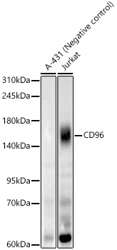 Western blot analysis of various lysates, using CD96 Rabbit mAb at 1:1000 dilution.|Secondary antibody: HRP-conjugated Goat anti-Rabbit IgG (H+L) at 1:10000 dilution.|Lysates/proteins: 25μg per lane.|Blocking buffer: 3% nonfat dry milk in TBST.|Detection: ECL Basic Kit.|Exposure time: 180s.