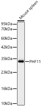 Western blot analysis of lysates from Mouse spleen, using [KD Validated] PHF11 Rabbit mAb at 1:2000 dilution.|Secondary antibody: HRP-conjugated Goat anti-Rabbit IgG (H+L) at 1:10000 dilution.|Lysates/proteins: 25μg per lane.|Blocking buffer: 3% nonfat dry milk in TBST.|Detection: ECL Basic Kit.|Exposure time: 30s.