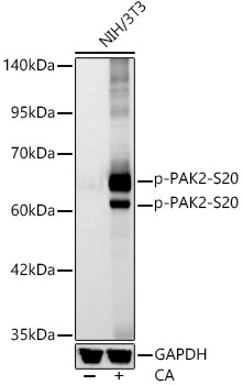 Western blot analysis of lysates from NIH/3T3 cells, using Phospho-PAK2-S20 Rabbit mAb at 1:2000 dilution. NIH/3T3 cells were treated with Calyculin A (100 nM) at 37℃ for 30 minutes after serum-starvation overnight.|Secondary antibody: HRP-conjugated Goat anti-Rabbit IgG (H+L) at 1:10000 dilution.|Lysates/proteins: 25μg per lane.|Blocking buffer: 3% nonfat dry milk in TBST.|Detection: ECL Basic Kit.|Exposure time: 10s.
