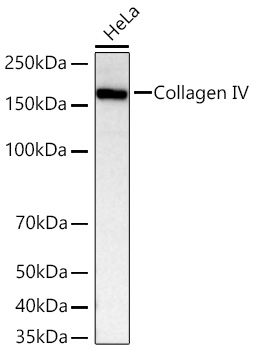 Western blot analysis of lysates from HeLa cells using Collagen IV Rabbit mAb at 1:7000 dilution incubated at room temperature for 1.5 hours.|Secondary antibody: HRP-conjugated Goat anti-Rabbit IgG (H+L) at 1:10000 dilution.|Lysates/proteins: 25 μg per lane.|Blocking buffer: 3% nonfat dry milk in TBST.|Detection: ECL Basic Kit.|Exposure time: 10 s.