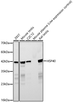 Western blot analysis of various lysates, using HSP40 Rabbit mAb at 1:1000 dilution.|Secondary antibody: HRP-conjugated Goat anti-Rabbit IgG (H+L) at 1:10000 dilution.|Lysates/proteins: 25μg per lane.|Blocking buffer: 3% nonfat dry milk in TBST.|Detection: ECL Basic Kit.|Exposure time: 45s.