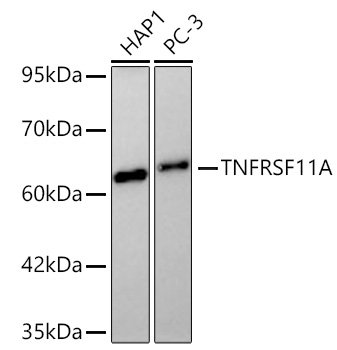 Western blot analysis of various lysates using TNFRSF11A Rabbit mAb at 1:1000 dilution incubated overnight at 4℃.|Secondary antibody: HRP-conjugated Goat anti-Rabbit IgG (H+L) at 1:10000 dilution.|Lysates/proteins: 25 μg per lane.|Blocking buffer: 3% nonfat dry milk in TBST.|Detection: ECL Basic Kit.|Exposure time: 20s.