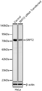 Western blot analysis of lysates from HeLa cells transfected with SRP72 siRNA using [KD Validated] SRP72 Rabbit mAb at 1:3000 dilution. |Secondary antibody:HRP Goat Anti-Rabbit IgG (H+L) at 1:10000 dilution.|Lysates/proteins: 18 μg per lane.|Blocking buffer: 3% nonfat dry milk in TBST.|Detection: ECL Basic Kit.|Exposure time: 30s.