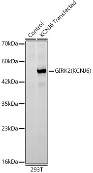 Western blot analysis of lysates from wild type (WT) and 293T cells transfected with KCNJ6 using GIRK2(KCNJ6) Rabbit mAb at 1:1000 dilution.|Secondary antibody: HRP-conjugated Goat anti-Rabbit IgG (H+L) at 1:10000 dilution.|Lysates/proteins: 25μg per lane.|Blocking buffer: 3% nonfat dry milk in TBST.|Detection: ECL Basic Kit.|Exposure time: 30s.