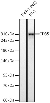 Western blot analysis of various lysates using CD35 Rabbit mAb at 1:1000 dilution.|Secondary antibody: HRP-conjugated Goat anti-Rabbit IgG (H+L) at 1:10000 dilution.|Lysates/proteins: 25 μg per lane.|Blocking buffer: 3% nonfat dry milk in TBST.|Detection: ECL Basic Kit.|Negative control (NC): THP-1.|Exposure time: 90s.
