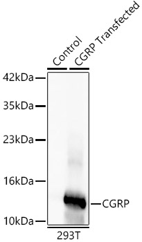 Western blot analysis of lysates from control 293T cells and CGRP-293T transfected cells, using CGRP Rabbit mAb at 1:2000 dilution.|Secondary antibody: HRP-conjugated Goat anti-Rabbit IgG (H+L) at 1:10000 dilution.|Lysates/proteins: 25μg per lane.|Blocking buffer: 3% nonfat dry milk in TBST.|Detection: ECL Basic Kit.|Exposure time: 15s.
