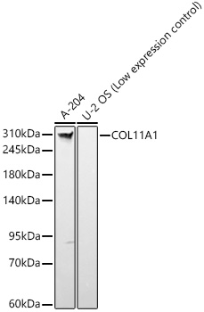 Western blot analysis of various lysates, using COL11A1 Rabbit mAb at 1:2000 dilution.|Secondary antibody: HRP-conjugated Goat anti-Rabbit IgG (H+L) at 1:10000 dilution.|Lysates/proteins: 25μg per lane.|Blocking buffer: 3% nonfat dry milk in TBST.|Detection: ECL Basic Kit.|Exposure time: 1s.