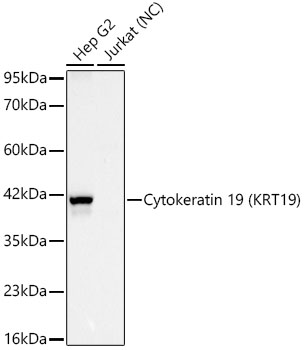 Western blot analysis of various lysates using Cytokeratin 19 (KRT19) Rabbit mAb at 1:5000 dilution incubated overnight at 4℃.| Secondary antibody: HRP-conjugated Goat anti-Rabbit IgG (H+L) at 1:10000 dilution.| Lysates / proteins: 25 μg per lane.| Blocking buffer: 3 % nonfat dry milk in TBST.| Detection: ECL Basic Kit.|Negative control (NC):Jurkat.| Exposure time: 45s.