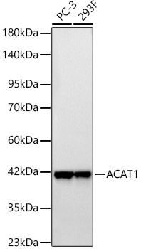Western blot analysis of various lysates, using ACAT1 Rabbit mAb at 1:9000 dilution.|Secondary antibody: HRP-conjugated Goat anti-Rabbit IgG (H+L) at 1:10000 dilution.|Lysates/proteins: 25μg per lane.|Blocking buffer: 3% nonfat dry milk in TBST.|Detection: ECL Basic Kit.|Exposure time: 10s.